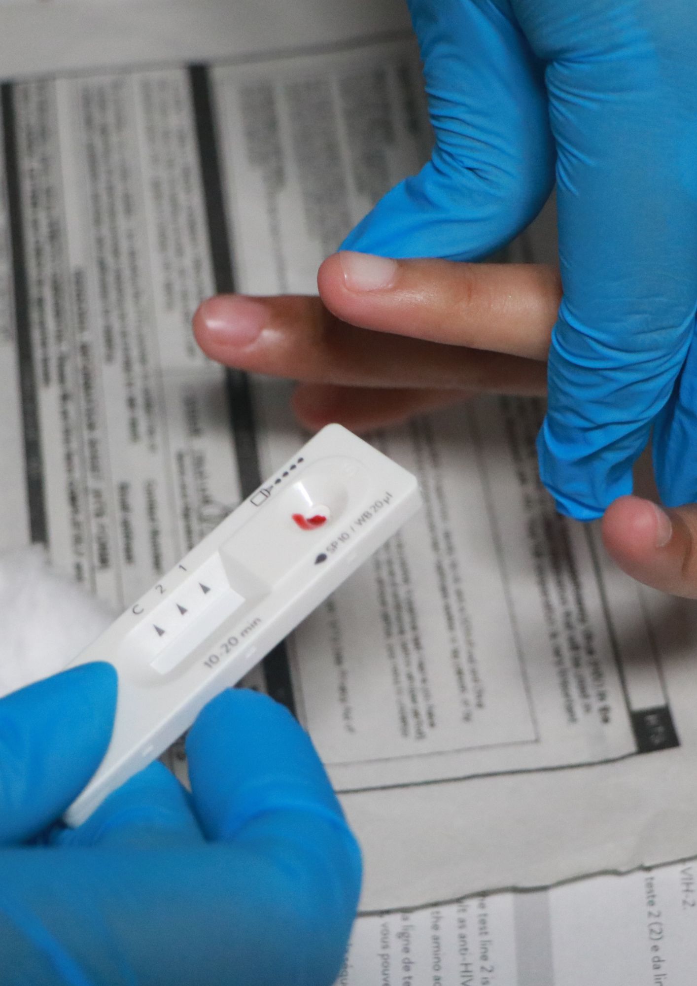 HIV